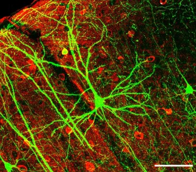 Neurons in the Brain, Image 1